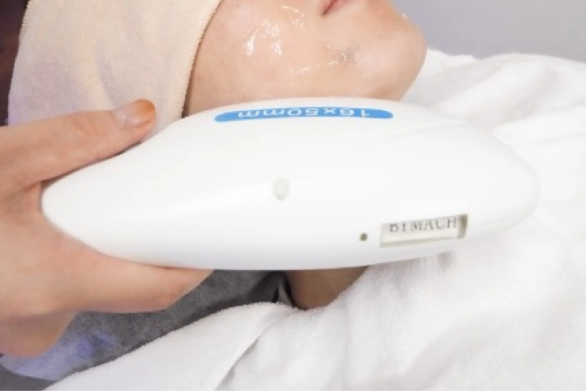 光脱毛清潔感あるお肌へ