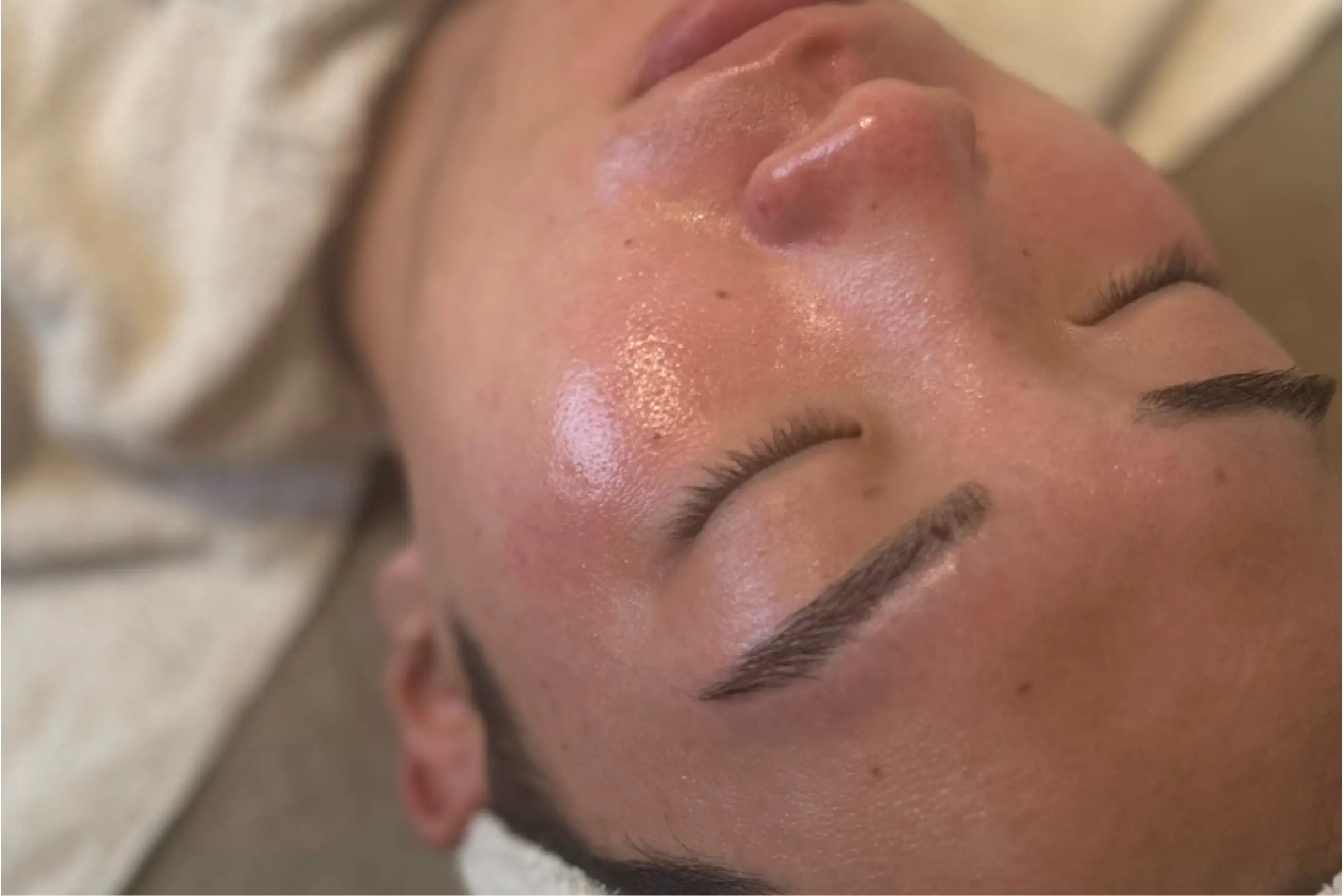 フェイシャルメニュー透明感あふれるツヤ肌